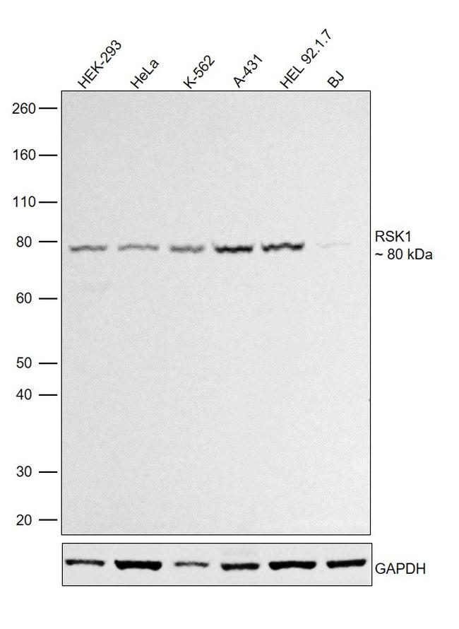 RSK1 Antibody in Western Blot (WB)