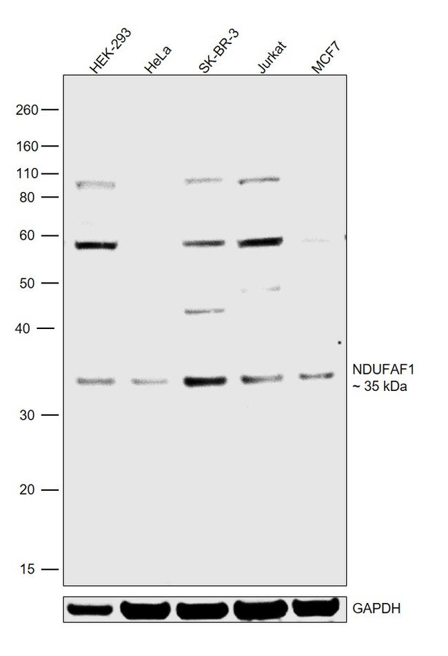 NDUFAF1 Antibody in Western Blot (WB)