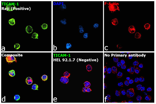 TRIF Antibody in Immunocytochemistry (ICC/IF)