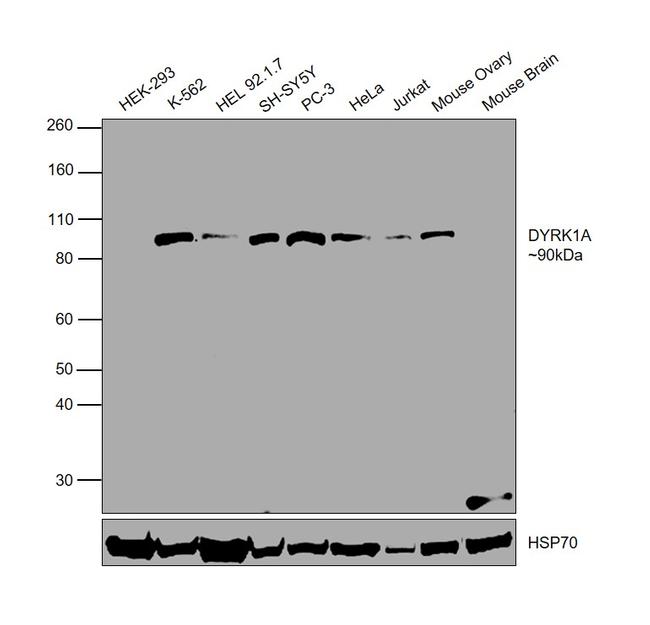 DYRK1A Antibody in Western Blot (WB)