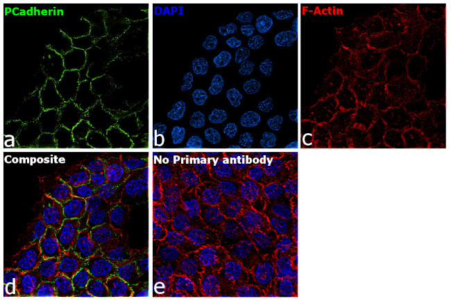 P-cadherin Antibody in Immunocytochemistry (ICC/IF)