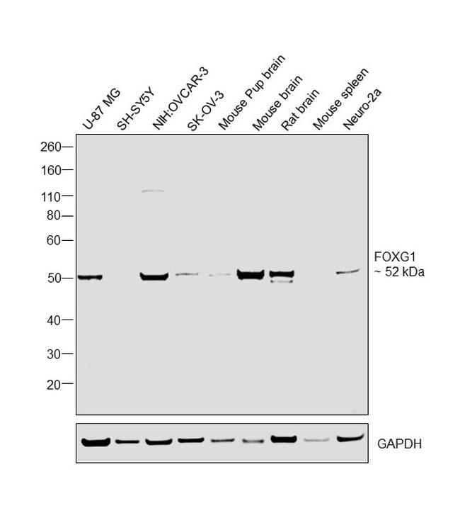 FOXG1 Antibody in Western Blot (WB)