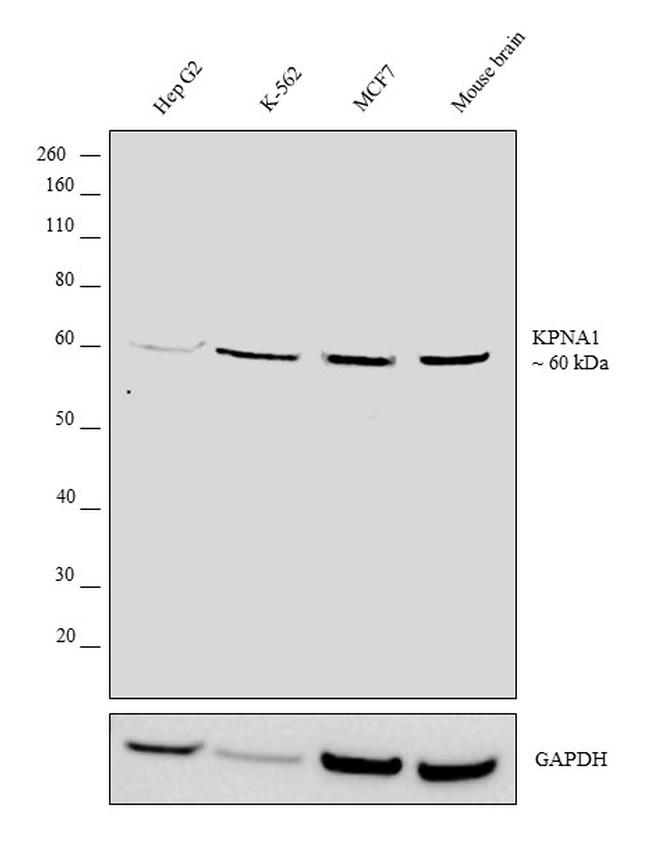 KPNA1 Antibody in Western Blot (WB)