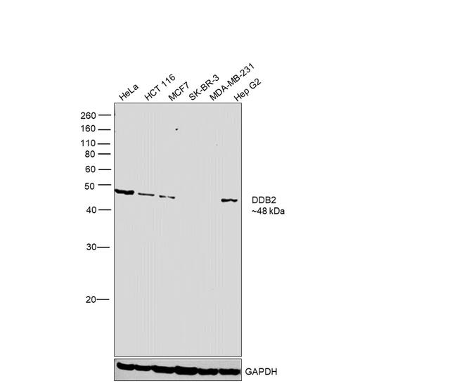 DDB2 Antibody in Western Blot (WB)