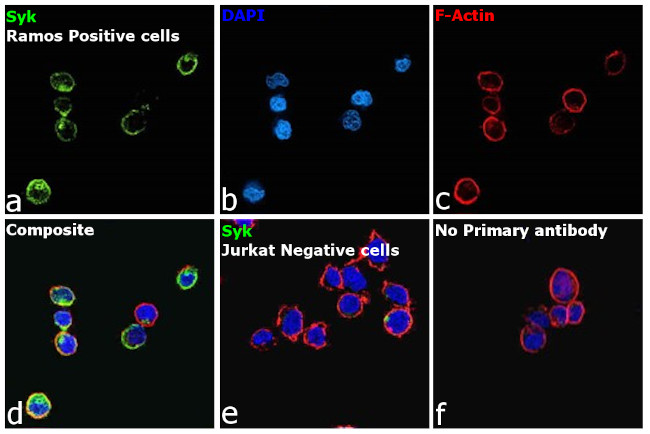 Syk Antibody in Immunocytochemistry (ICC/IF)