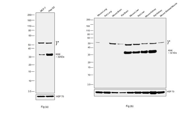 KHK Antibody in Western Blot (WB)