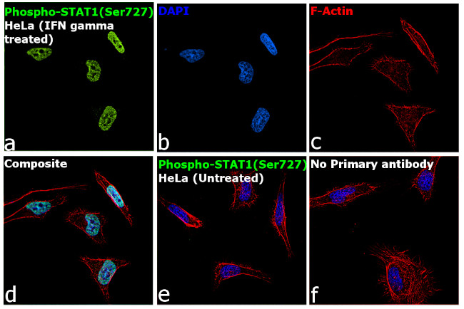 Phospho-STAT1 (Ser727) Antibody in Immunocytochemistry (ICC/IF)