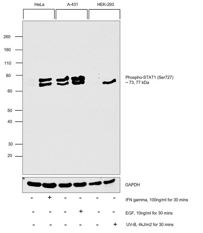 Phospho-STAT1 (Ser727) Antibody in Western Blot (WB)