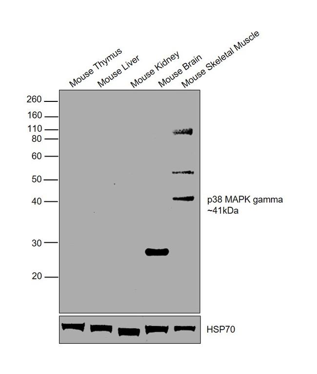 p38 MAPK gamma Antibody in Western Blot (WB)