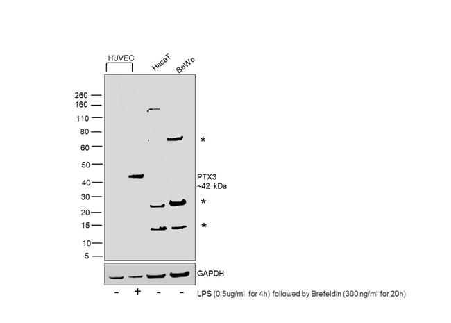 PTX3 Antibody in Western Blot (WB)