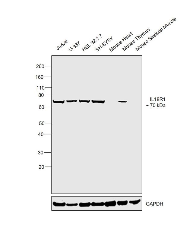 IL18R1 Antibody in Western Blot (WB)