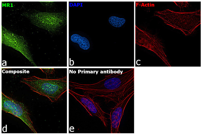 MR1 Antibody in Immunocytochemistry (ICC/IF)