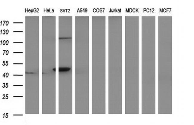 PAAF1 Antibody in Western Blot (WB)