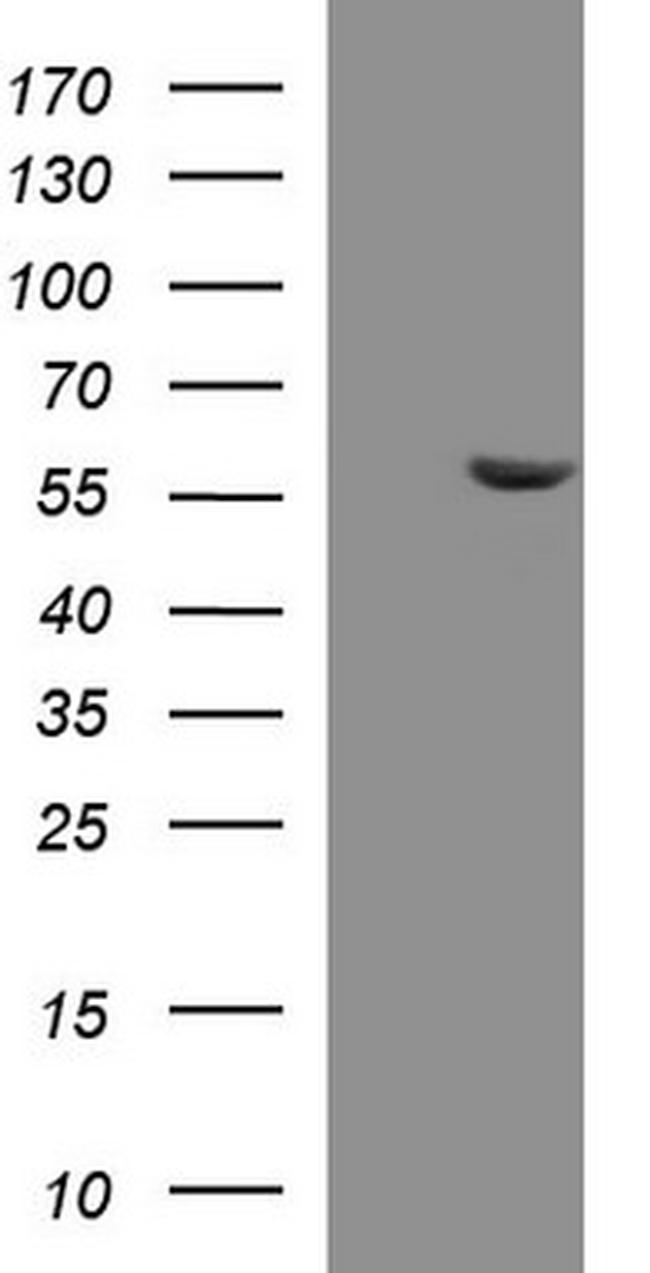 PAAF1 Antibody in Western Blot (WB)