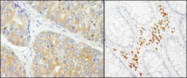 PABP4 Antibody in Immunohistochemistry (IHC)