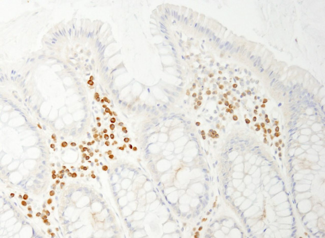 PABP4 Antibody in Immunohistochemistry (IHC)