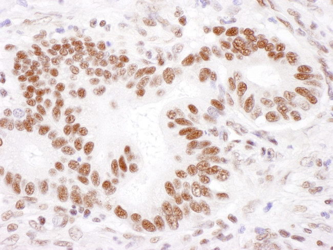 PABPN1 Antibody in Immunohistochemistry (IHC)