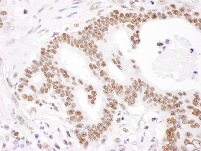 PABPN1 Antibody in Immunohistochemistry (IHC)