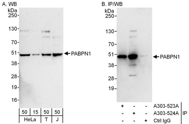 PABPN1 Antibody in Western Blot (WB)