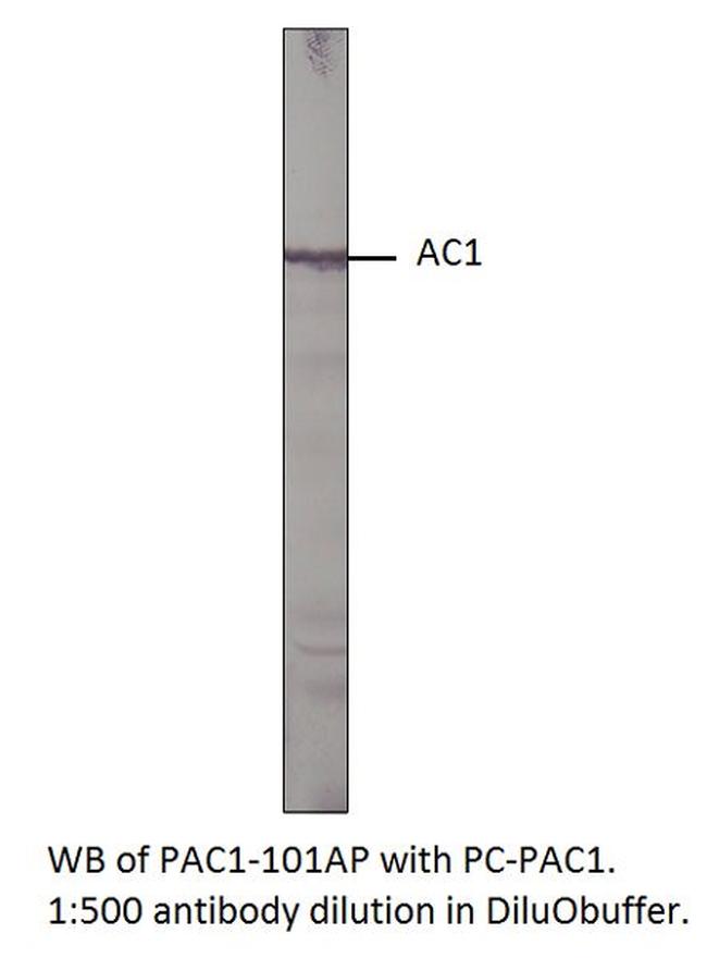 Adenylate cyclase 1 Antibody in Western Blot (WB)