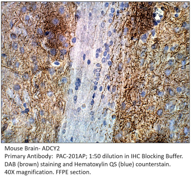 ADCY2 Antibody in Immunohistochemistry (IHC)