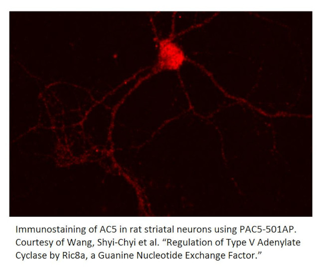 ADCY5 Antibody in Immunohistochemistry (IHC)