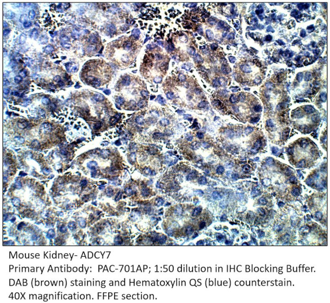 ADCY7 Antibody in Immunohistochemistry (IHC)