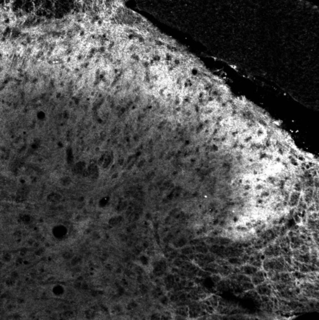 PACAP Receptor Antibody in Immunohistochemistry (Paraffin) (IHC (P))