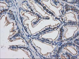 PACSIN3 Antibody in Immunohistochemistry (Paraffin) (IHC (P))