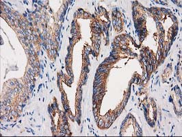 PACSIN3 Antibody in Immunohistochemistry (Paraffin) (IHC (P))