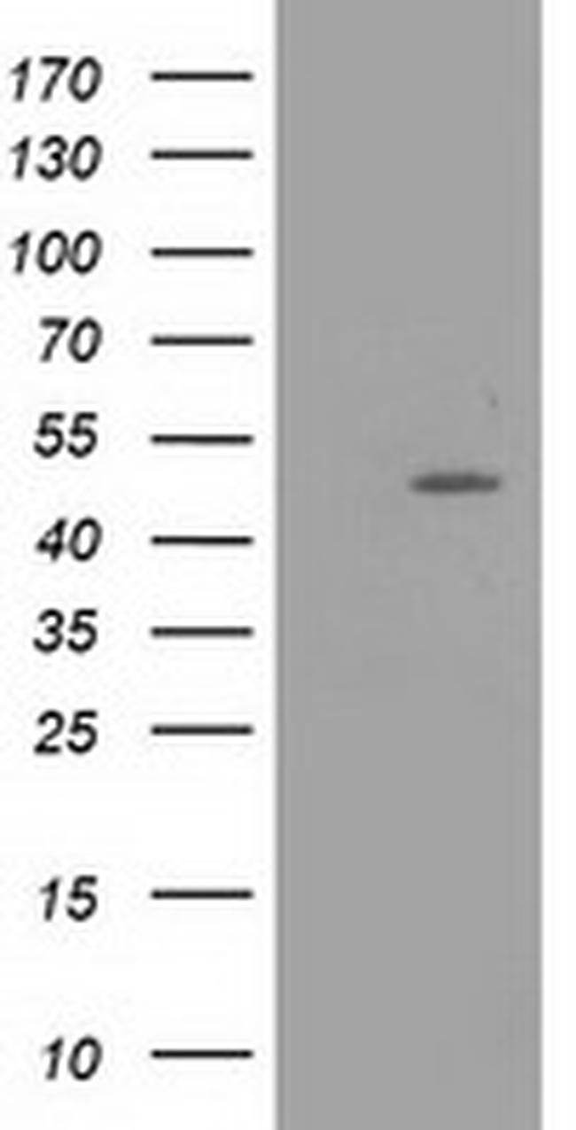 PACSIN3 Antibody in Western Blot (WB)