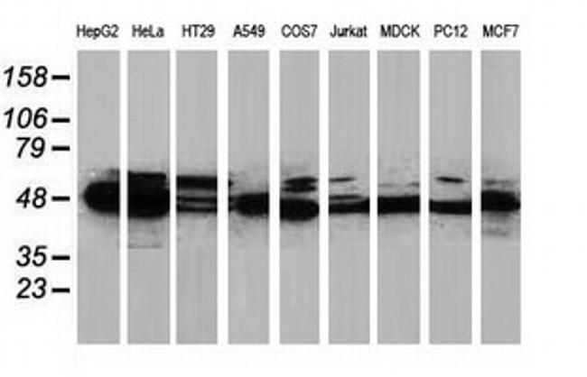 PACSIN3 Antibody in Western Blot (WB)