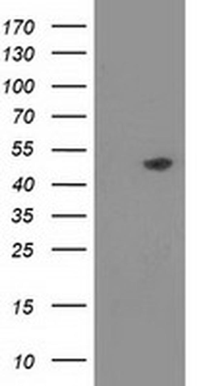 PACSIN3 Antibody in Western Blot (WB)