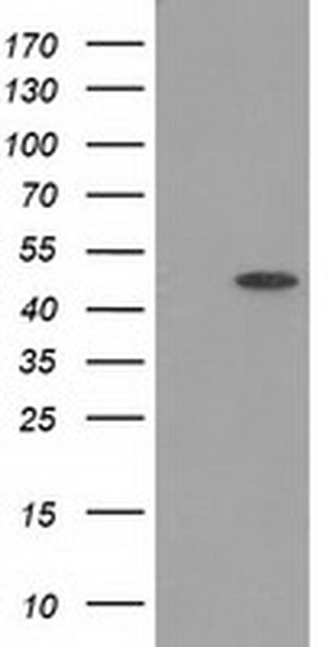 PACSIN3 Antibody in Western Blot (WB)