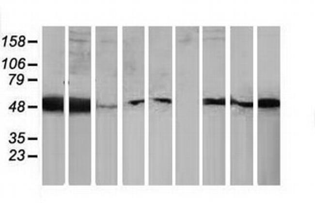 PACSIN3 Antibody in Western Blot (WB)