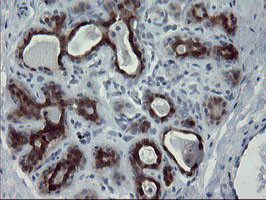 PADI4 Antibody in Immunohistochemistry (Paraffin) (IHC (P))