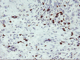 PADI4 Antibody in Immunohistochemistry (Paraffin) (IHC (P))