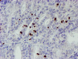 PADI4 Antibody in Immunohistochemistry (Paraffin) (IHC (P))