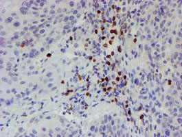 PADI4 Antibody in Immunohistochemistry (Paraffin) (IHC (P))