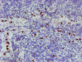 PADI4 Antibody in Immunohistochemistry (Paraffin) (IHC (P))