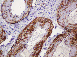 PADI4 Antibody in Immunohistochemistry (Paraffin) (IHC (P))