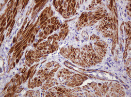 PADI4 Antibody in Immunohistochemistry (Paraffin) (IHC (P))