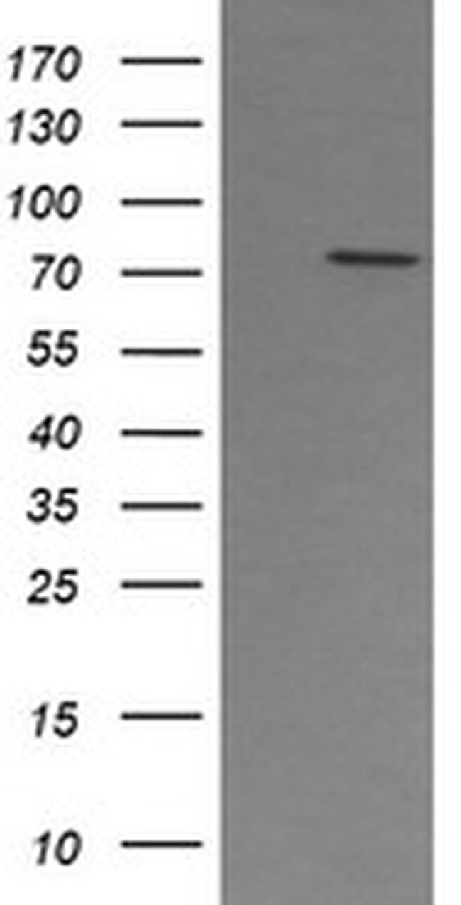 PADI4 Antibody in Western Blot (WB)