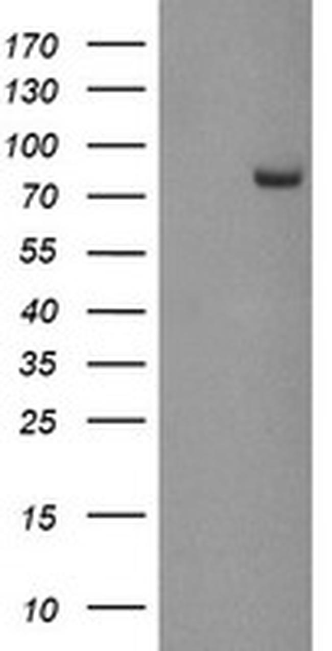 PADI4 Antibody in Western Blot (WB)