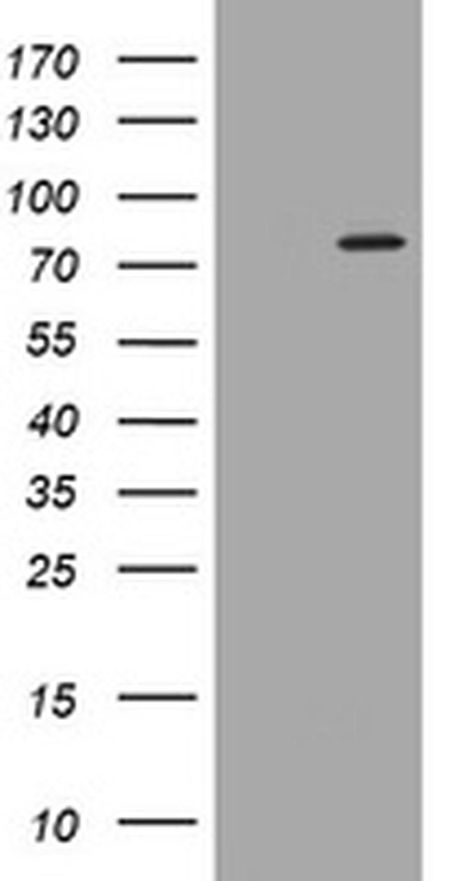 PADI4 Antibody in Western Blot (WB)