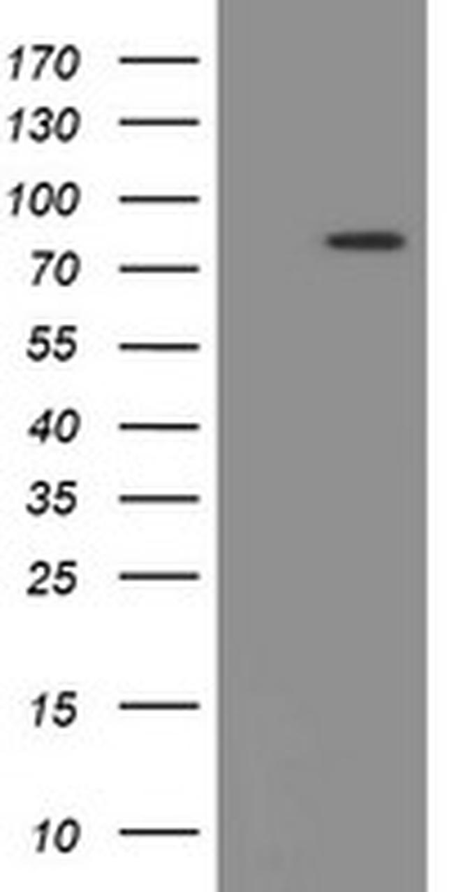 PADI4 Antibody in Western Blot (WB)