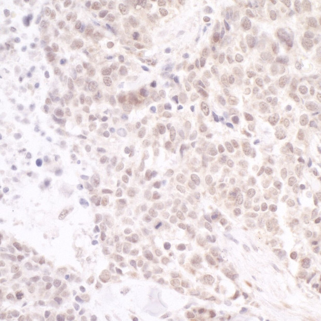 PAF49 Antibody in Immunohistochemistry (IHC)