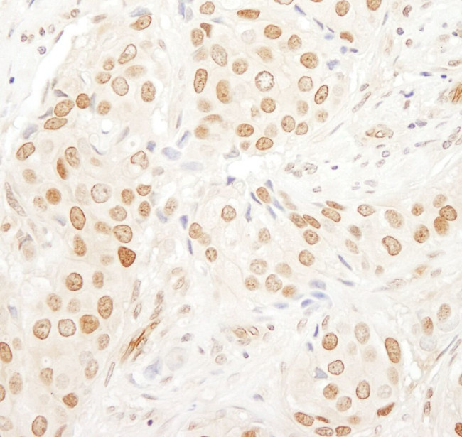 PAF49 Antibody in Immunohistochemistry (IHC)