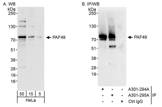 PAF49 Antibody in Western Blot (WB)