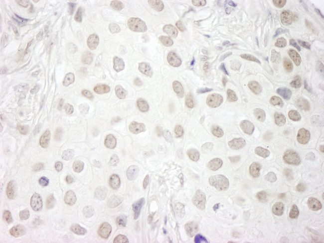 PAF49 Antibody in Immunohistochemistry (IHC)